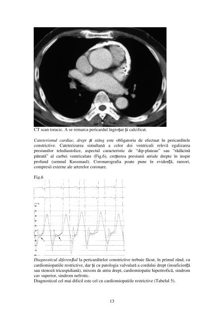 Cap.IX Pericarditele - Cardiologie.ro