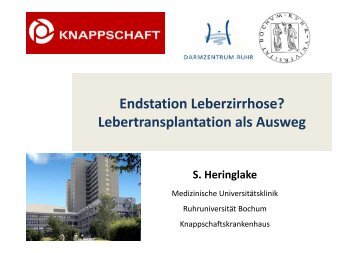 Lebertransplantation als Ausweg - Knappschaftskrankenhaus Bochum