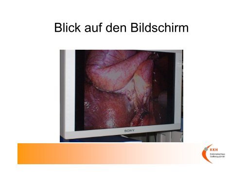 LESS Laparo-Endoskopic single site surgery - Kreiskrankenhaus ...