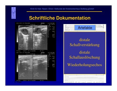 Vortrag anzeigen - Kreiskrankenhaus Stollberg gGmbH