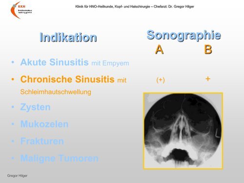 Ultraschall â Workshop B-Sonographie der NNH im Vergleich mit ...