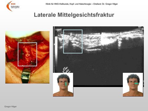 Ultraschall â Workshop B-Sonographie der NNH im Vergleich mit ...