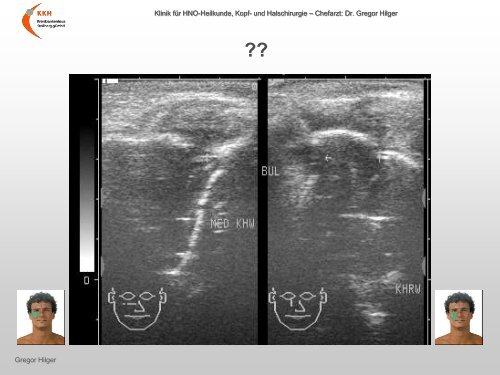 Ultraschall â Workshop B-Sonographie der NNH im Vergleich mit ...