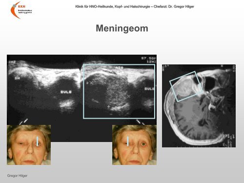 Ultraschall â Workshop B-Sonographie der NNH im Vergleich mit ...