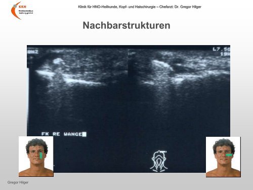 Ultraschall â Workshop B-Sonographie der NNH im Vergleich mit ...