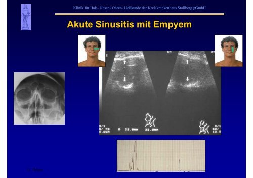 B-Sonographie der NNH - Kreiskrankenhaus Stollberg gGmbH