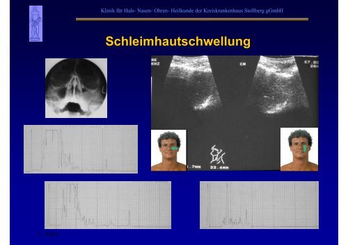 B-Sonographie der NNH - Kreiskrankenhaus Stollberg gGmbH