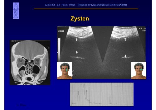 B-Sonographie der NNH - Kreiskrankenhaus Stollberg gGmbH