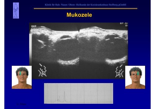 B-Sonographie der NNH - Kreiskrankenhaus Stollberg gGmbH