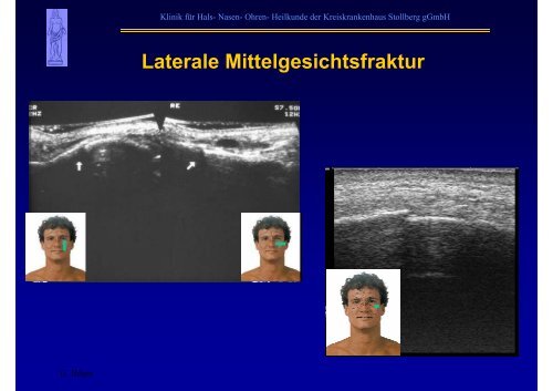 B-Sonographie der NNH - Kreiskrankenhaus Stollberg gGmbH