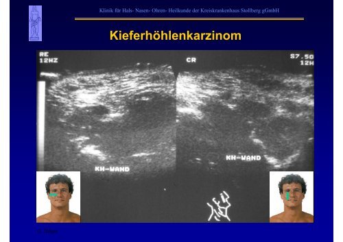 B-Sonographie der NNH - Kreiskrankenhaus Stollberg gGmbH