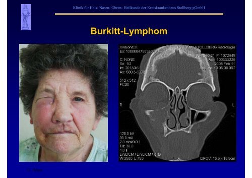 B-Sonographie der NNH - Kreiskrankenhaus Stollberg gGmbH