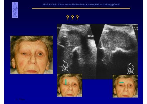 B-Sonographie der NNH - Kreiskrankenhaus Stollberg gGmbH