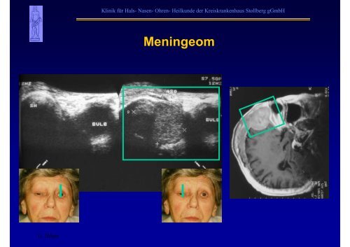 B-Sonographie der NNH - Kreiskrankenhaus Stollberg gGmbH