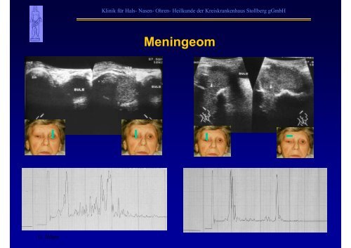 B-Sonographie der NNH - Kreiskrankenhaus Stollberg gGmbH