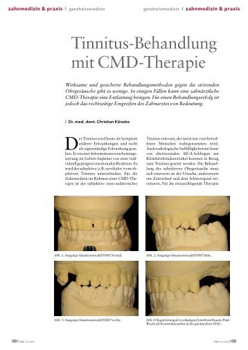 Tinnitus-Behandlung mit CMD-Therapie - koeneke-schroeder.de