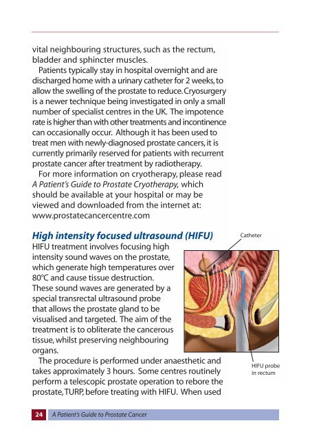 A Patient's Guide to Prostate Cancer - Prostate Cancer Centre