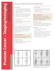 Prostate Cancer – Staging/restaging case study - Cardinal Health