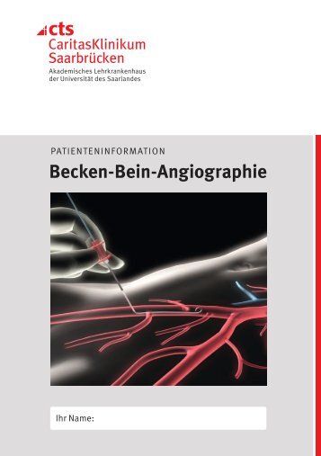 Becken-Bein-Angiographie - Caritasklinik St. Theresia