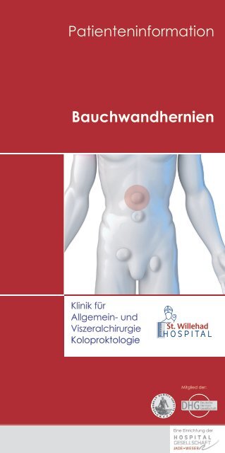 Bauchwandhernien - St. Willehad-Hospital