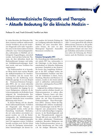 Nuklearmedizinische Diagnostik und Therapie – Aktuelle ...