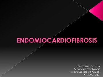 Endomiocardiofibrosis - FaC