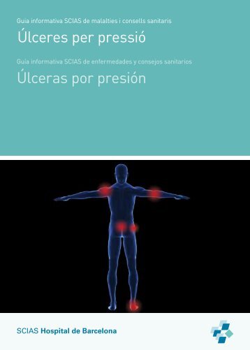 Úlceres per pressió (UPP) - Hospital de Barcelona