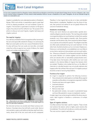 Irrigation - Root Canal Clinic - Dr. Siju Jacob MDS