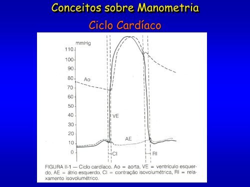 curvas de pressão intracavitária, gradientes e cálculo do ... - SBHCI