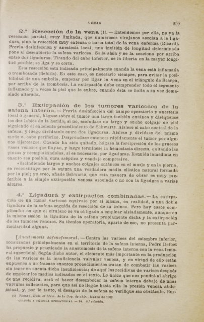 La vena de safena corta ligadura