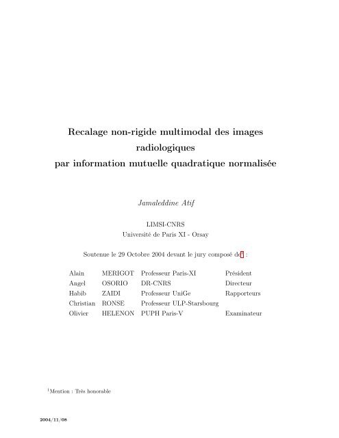 Recalage non-rigide multimodal des images radiologiques ... - Limsi