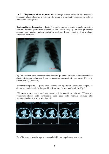 Cap.X Tromboembolismul pulmonar - Cardiologie.ro