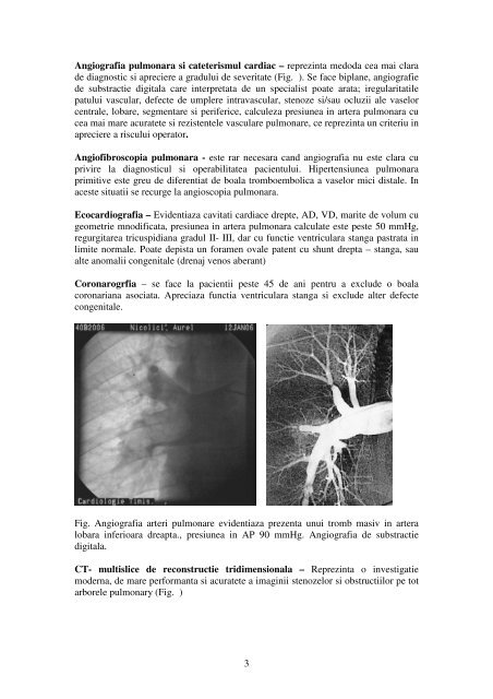 Cap.X Tromboembolismul pulmonar - Cardiologie.ro