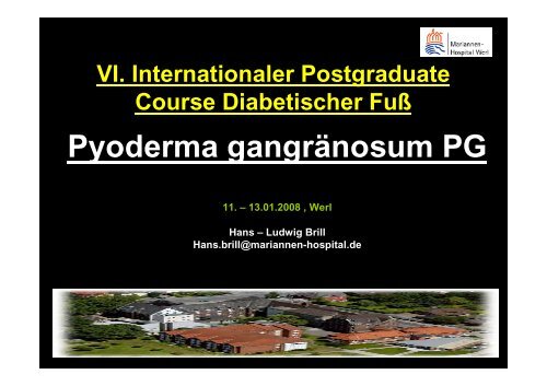Pyoderma gangränosum PG - Katharinen-Hospital
