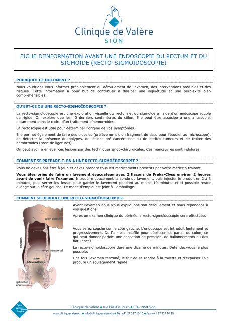Rectosigmoidoscopie douloureux Rectosigmoidoscopie douloureux