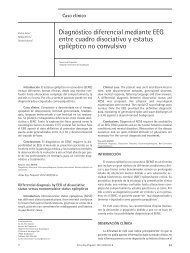 Diagnóstico diferencial mediante EEG entre cuadro disociativo y ...