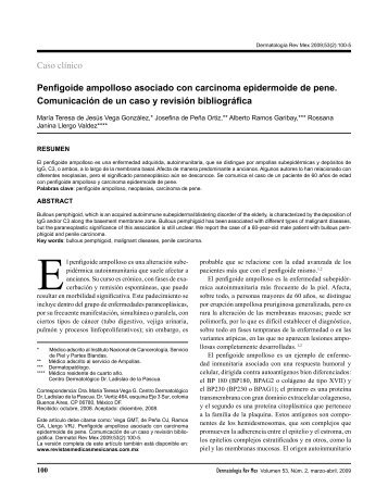 Penfigoide ampolloso asociado con carcinoma epidermoide de ...