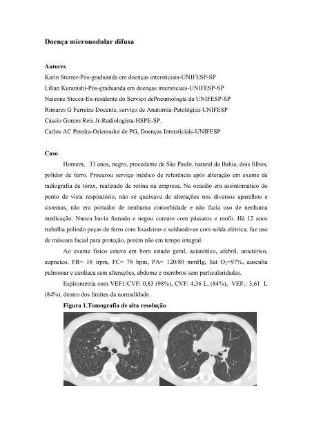 Doença micronodular difusa