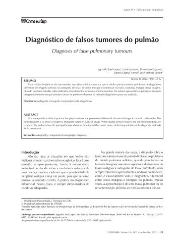 artigo 02 - Denise - Sociedade de Pneumologia e Tisiologia do ...