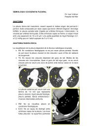 SEMIOLOGIA I ECOGRAFIA PLEURAL Dr. Ivan Vollmer Hospital del ...