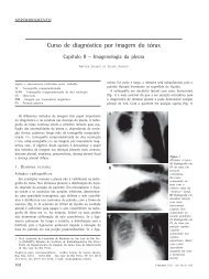 PDF em Português - Jornal Brasileiro de Pneumologia