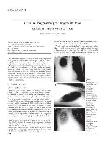 PDF em Português - Jornal Brasileiro de Pneumologia