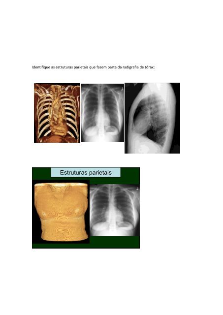 ESTRUTURAS PARIETAIS NA RADIOGRAFIA DO TÓRAX ... - UniFOA