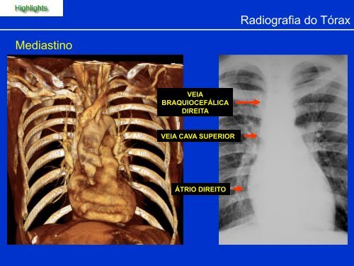 Métodos de Diagnóstico por Imagem aplicados ao Tórax