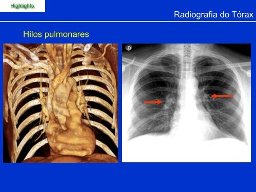 Métodos de Diagnóstico por Imagem aplicados ao Tórax