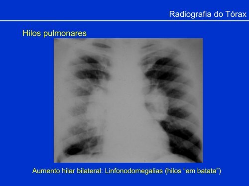 Métodos de Diagnóstico por Imagem aplicados ao Tórax