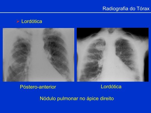 Métodos de Diagnóstico por Imagem aplicados ao Tórax