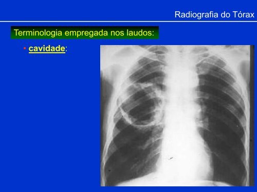 Métodos de Diagnóstico por Imagem aplicados ao Tórax