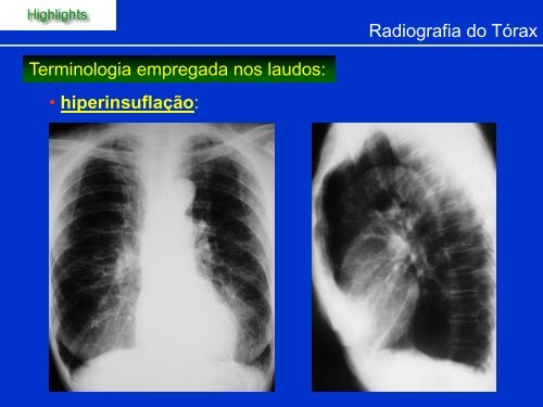 Métodos de Diagnóstico por Imagem aplicados ao Tórax