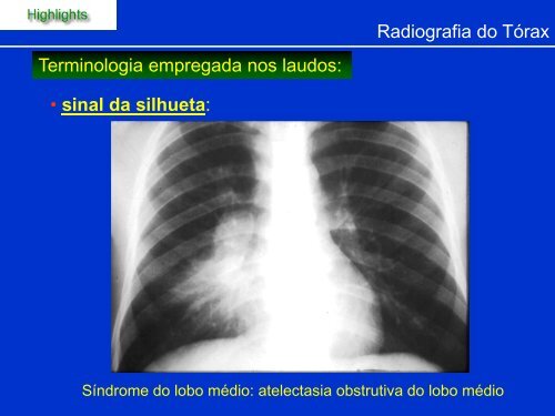 Métodos de Diagnóstico por Imagem aplicados ao Tórax